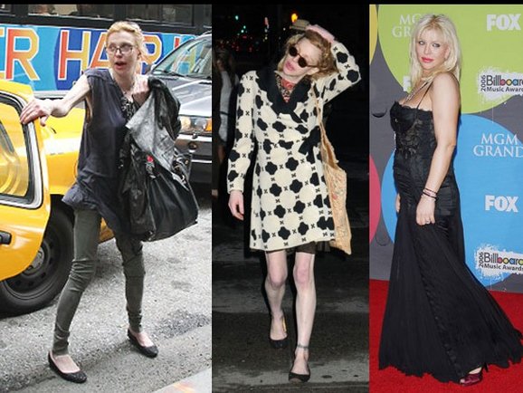 Nezdravo mršave celebrity dame