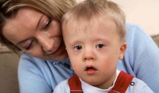 Down sindrom (Foto: qmagazine.ro)