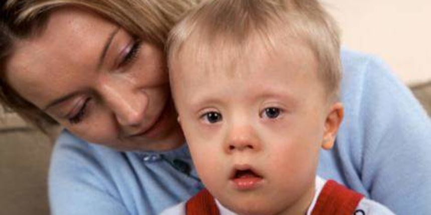 Down sindrom (Foto: qmagazine.ro) Down sindrom (Foto: qmagazine.ro)