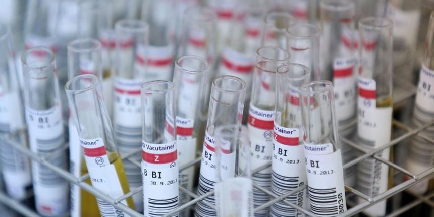 Četiri nove kemikalije dodane na popis kancerogenih tvari, Foto: Slavko Midžor/PIXSELL Četiri nove kemikalije dodane na popis kancerogenih tvari, Foto: Slavko Midžor/PIXSELL