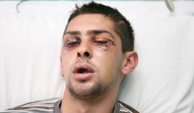 Alen Ajkić (Foto:Index.hr/CROPIX)