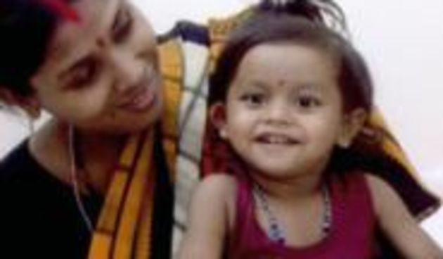 Lakshmi Tatma s majkom prije operacije/Foto: www.timesonline.co.uk