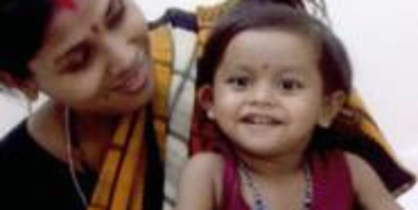 Lakshmi Tatma s majkom prije operacije/Foto: www.timesonline.co.uk Lakshmi Tatma s majkom prije operacije/Foto: www.timesonline.co.uk