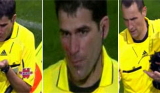 Napadnuti sudac / Marca.com