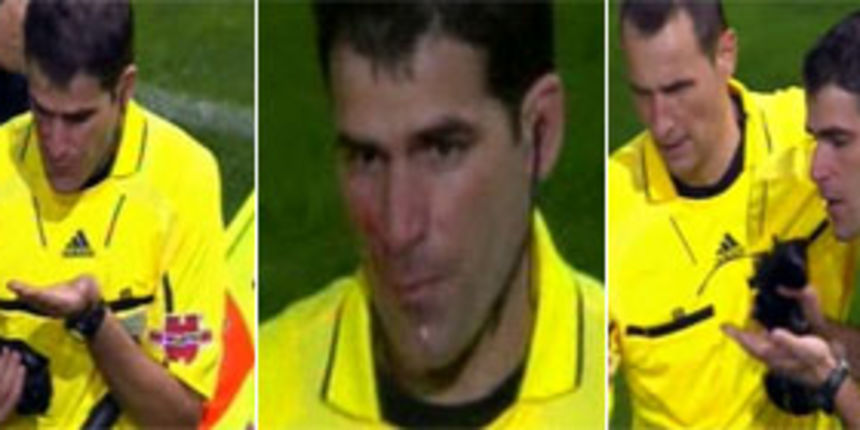 Napadnuti sudac / Marca.com Napadnuti sudac / Marca.com