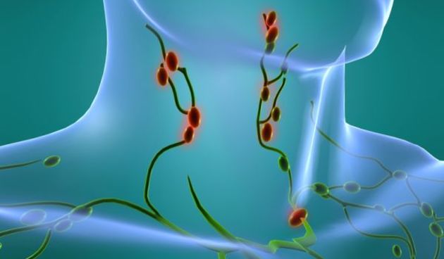 Limfom, foto: www.savjetnica.com