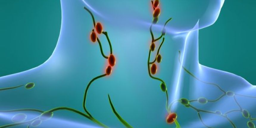 Limfom, foto: www.savjetnica.com