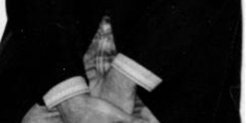 Popiškio hlaće (Foto: imageshack.us) Popiškio hlaće (Foto: imageshack.us)