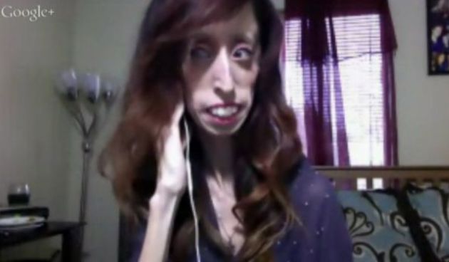 Lizzie Velasquez, Screenshot: Huffington Post