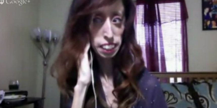 Lizzie Velasquez, Screenshot: Huffington Post Lizzie Velasquez, Screenshot: Huffington Post
