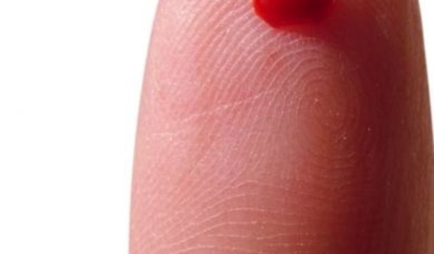 Krv za transfuziju iz uzorka kože