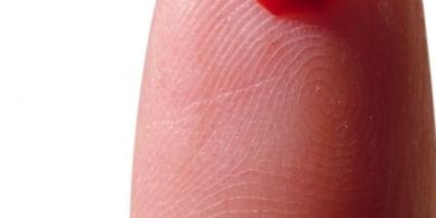 Krv za transfuziju iz uzorka kože Krv za transfuziju iz uzorka kože