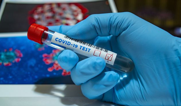 Koronavirus, Covid test negativan