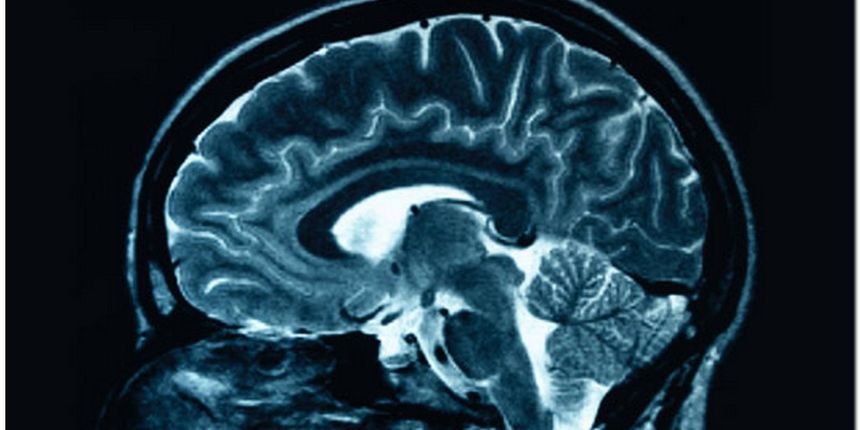 Multipla skleroza – ulje marihuane pomaže kod multiple skleroze, usporavajući njezin progres i ublažavajući simptome Multipla skleroza – ulje marihuane pomaže kod multiple skleroze, usporavajući njezin progres i ublažavajući simptome