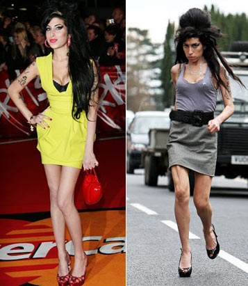 Nezdravo mršave celebrity dame