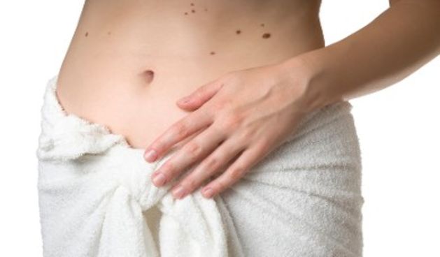 madeži, foto: thinkstock