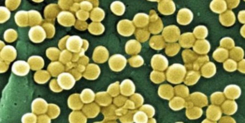 Svijetu prijeti nova vrsta super-bakterije? (Metro-portal.hr) Svijetu prijeti nova vrsta super-bakterije? (Metro-portal.hr)