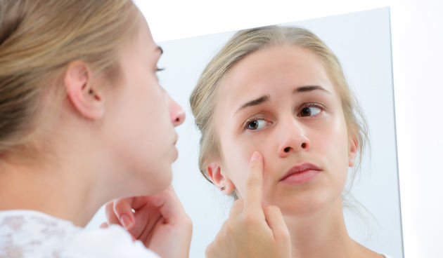 Tinejdžerica, prištići