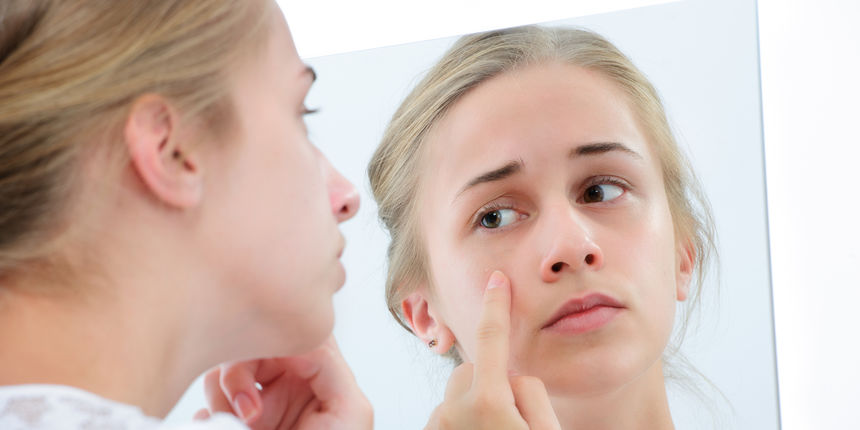 Tinejdžerica, prištići