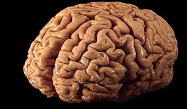 Mozak, foto: heppell.net