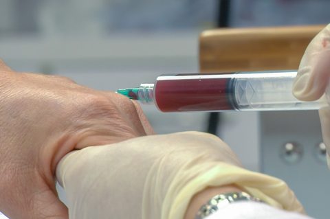 prp-plazma